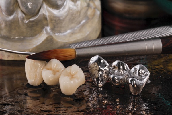 Ways To Take Care Of Your Dental Bridge