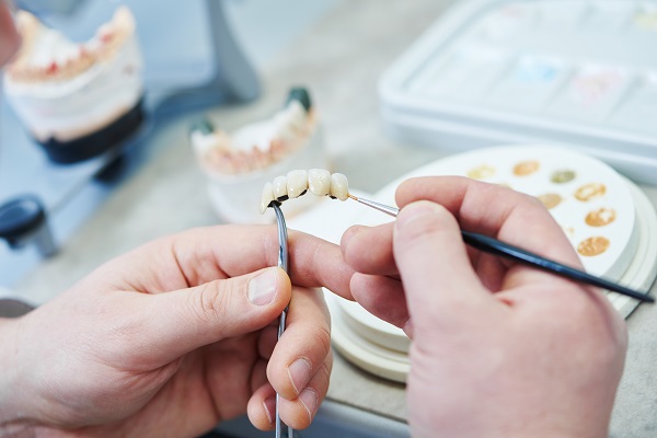 Replace Your Missing Teeth With A Dental Bridge