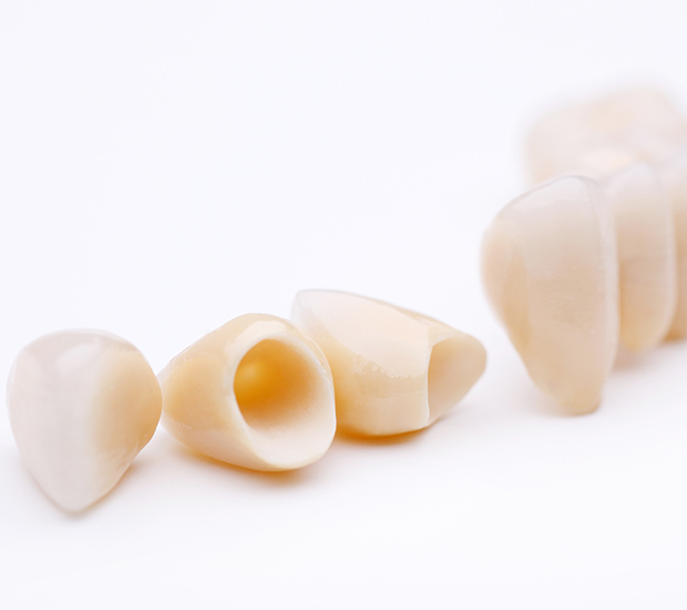 Plainview Dental Crowns and Dental Bridges
