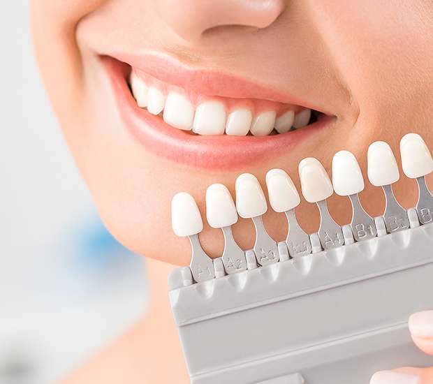 Plainview Dental Veneers and Dental Laminates
