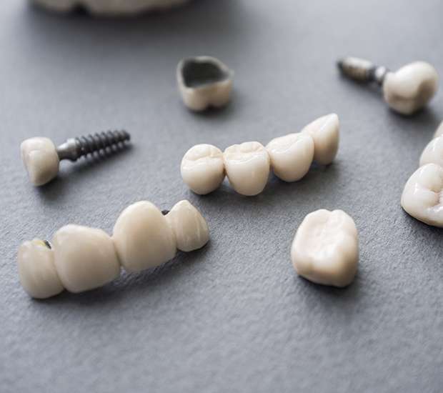 Plainview The Difference Between Dental Implants and Mini Dental Implants