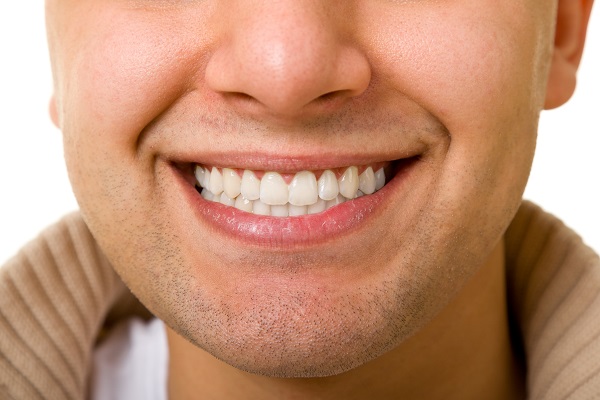 Professional Teeth Whitening Vs Over The Counter Teeth Whitening